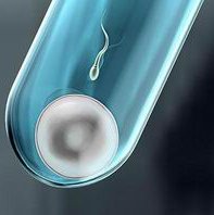 2026保定试管婴儿医院排行榜最新，附医院介绍及费用预估